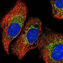QDPR Antibody, Novus Biologicals 0.1mL; Unlabeled:Antibodies, Polyclonal